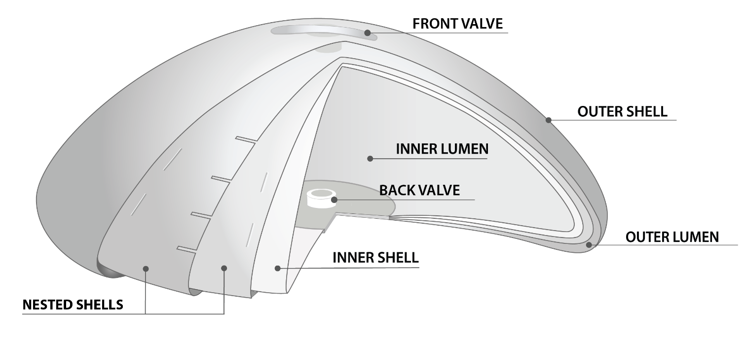 The layers of a Serene breast implant